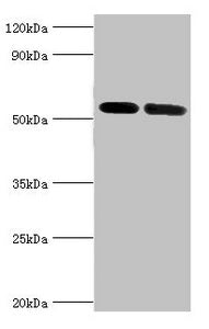 ATP6V1B1 Antibody