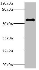 ATP6V1B2 Antibody