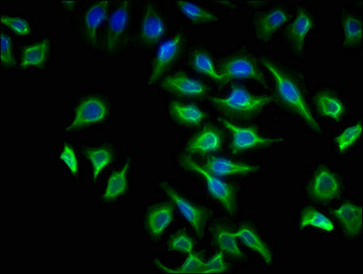 ATP6V1G2 Antibody