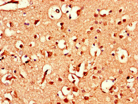 ATXN1L Antibody