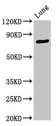 ATXN7 Antibody