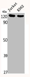 PTK2 Antibody
