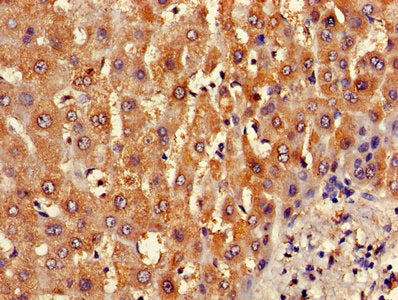B3GALT2 Antibody