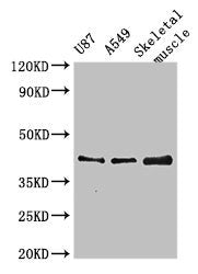 B3GALT4 Antibody