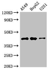 B4GALT2 Antibody