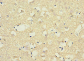 ADGRB1 Antibody