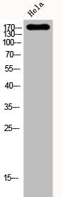 KDR Antibody