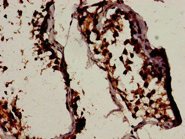 BCL2L11 Antibody