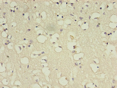 BDNF Antibody