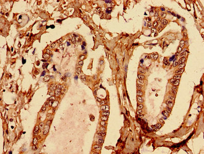 BGN Antibody