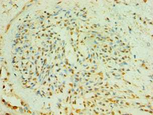 BLK Antibody