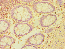 BMX Antibody