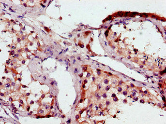 BRAF Antibody