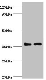 BRCC3 Antibody