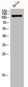 HDAC4 Antibody