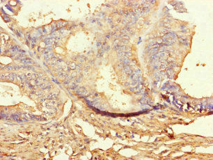 BUB1B Antibody