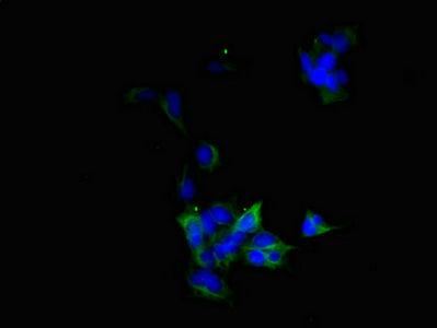 BVES Antibody