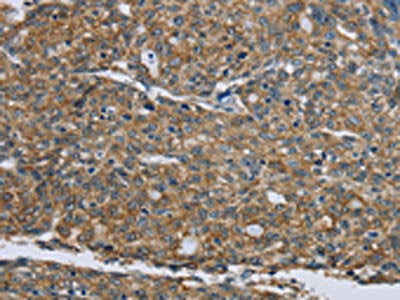 KRT5 Antibody