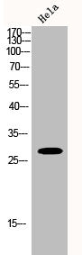 HOXB9 Antibody