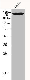 IGF1R/INSR Antibody