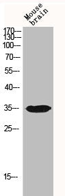 IGFBP3 Antibody