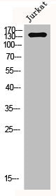 L1CAM Antibody