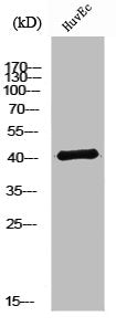 NTM Antibody