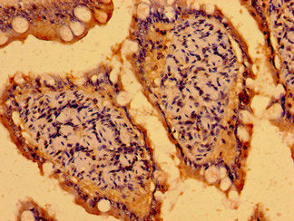 C19orf12 Antibody