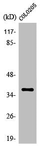 OR52B2 Antibody