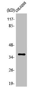 OR52E5 Antibody