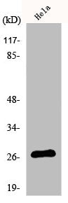 CDKN1B Antibody