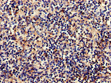 C1QA Antibody