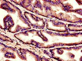 C1QC Antibody