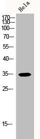 CDK5R1 Antibody