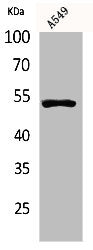 TP53 Antibody