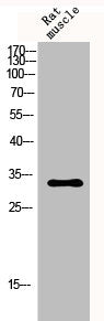 CDKN1C Antibody