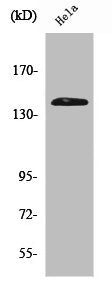 EIF2AK3 Antibody