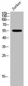 PFKFB1 Antibody