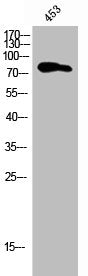 PIK3R2 Antibody