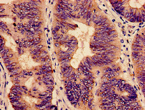 YBEY Antibody