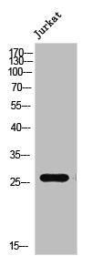 PRRX1 Antibody