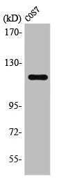 PTK2B Antibody