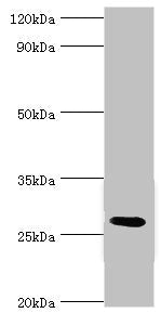 C4BPB Antibody