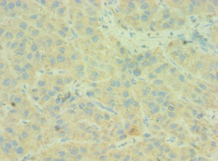 C4BPB Antibody