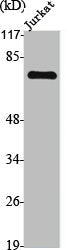 TGFBR2 Antibody