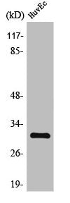TIMP3 Antibody