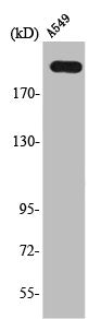 CACNA1H Antibody