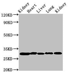 CA2 Antibody