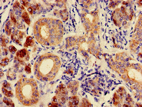 CA6 Antibody
