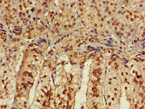 CACNB4 Antibody
